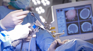 Сучасний підхід до складних нейрохірургічних втручань